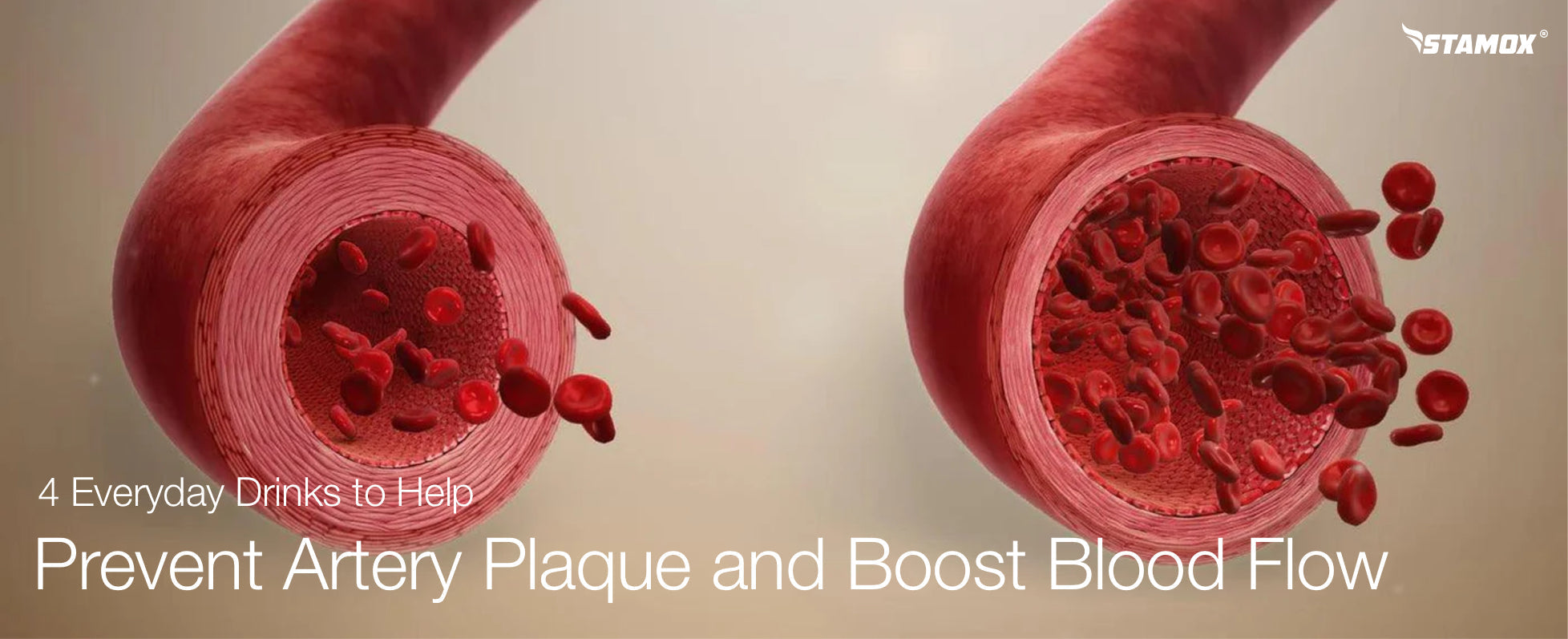 4 Everyday Drinks to Help Prevent Artery Plaque and Boost Blood Flow