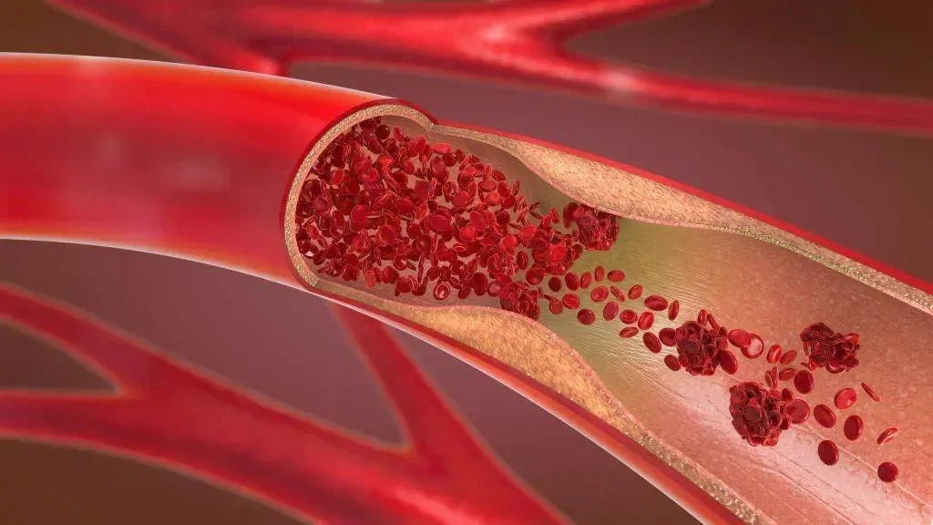 Best Time to Drink Beetroot Juice for High Blood Pressure